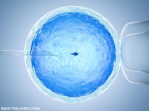 试管婴儿包生男孩公司